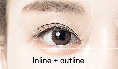 in-out-line double eyelid surgery