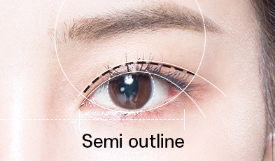 semi-out-line double eyelid surgery